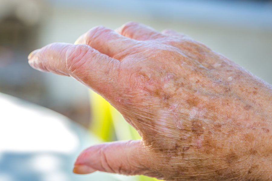 A close up of an old person 's hand